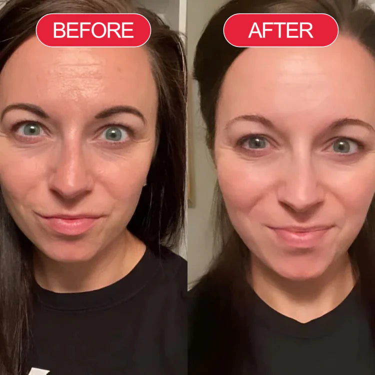 Koriderm™ Time Reverse Cream (All-In-One)