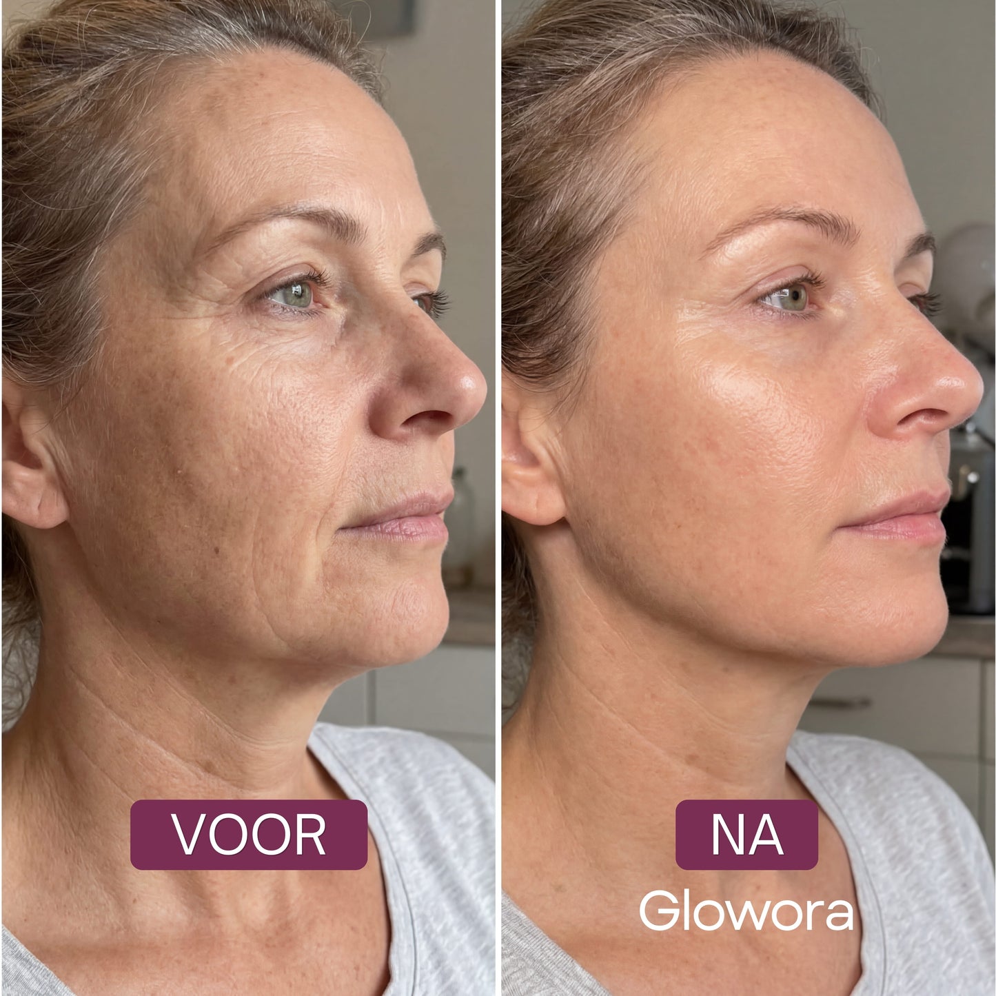 Vita Glass Skin Mask™
