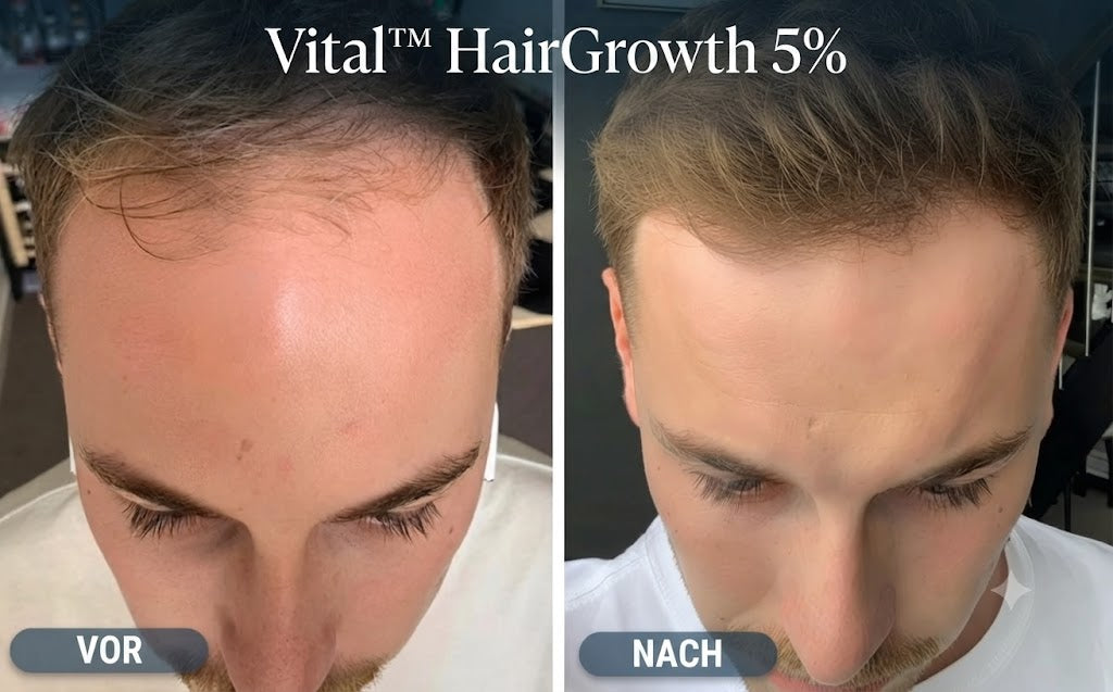 Vital™ HairGrowth 5% – Ansicht 3