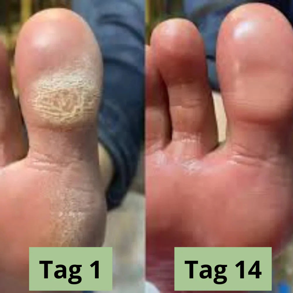 Lyvona CleanStep™