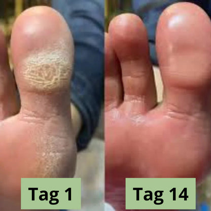 Lyvona CleanStep™