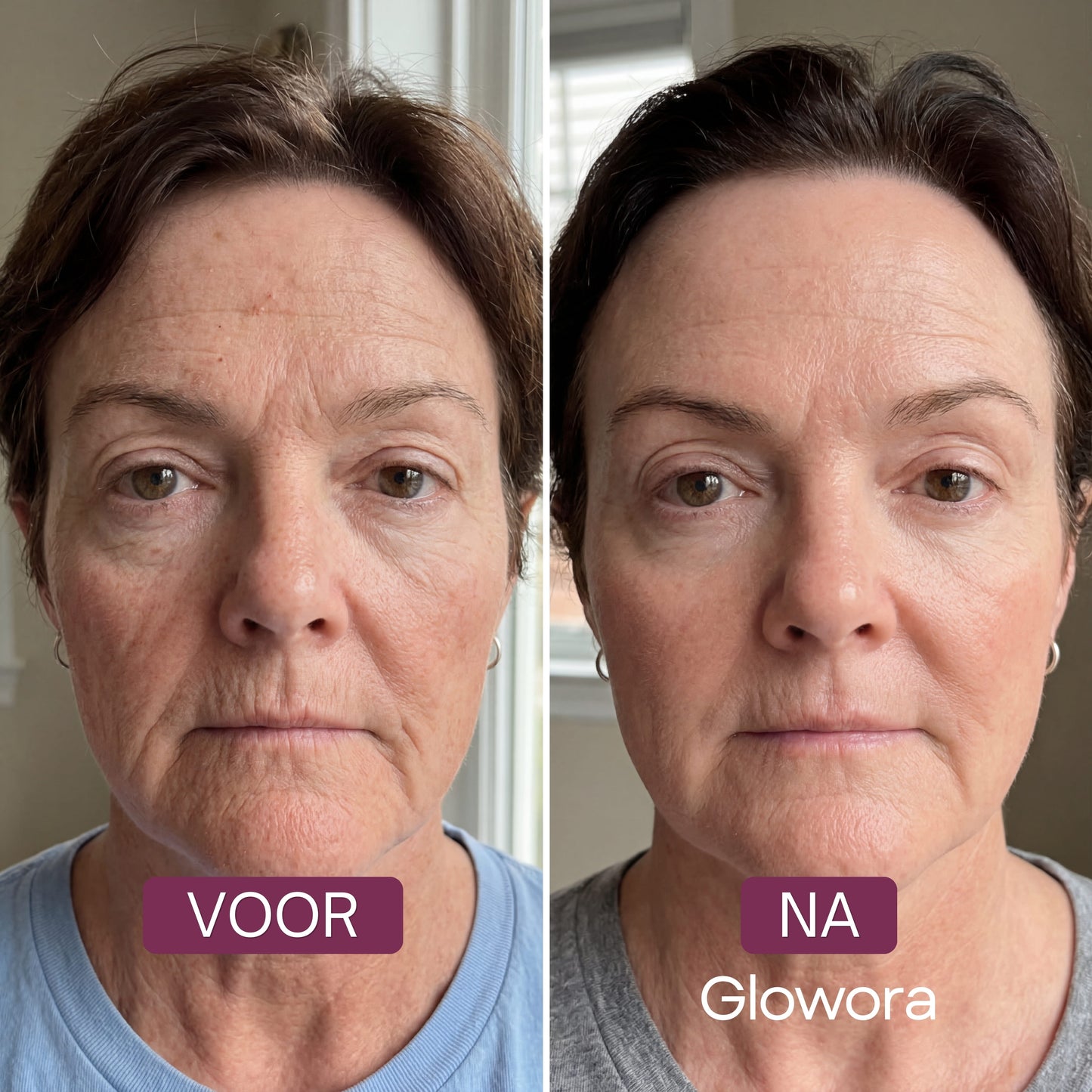 Vita Glass Skin Mask™