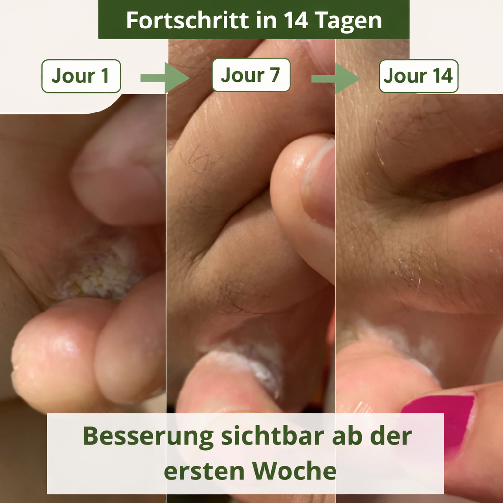 Lyvona CleanStep™