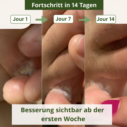 Lyvona CleanStep™