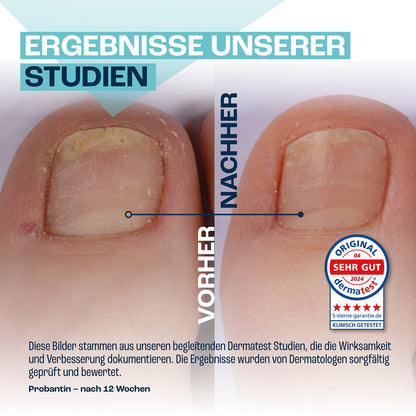 NAGELNEU Pflegendes Nagelgel 10ml