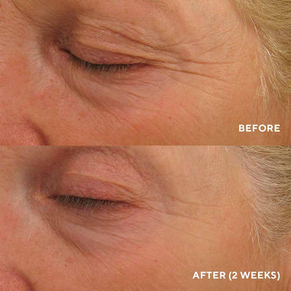Hydropeptide Eye Authority Travel