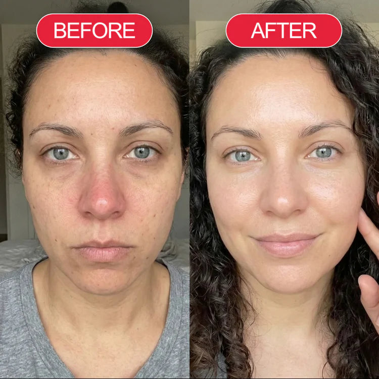 Koriderm™ Time Reverse Cream (All-In-One)