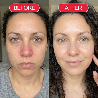 Koriderm™ Time Reverse Cream (All-In-One)