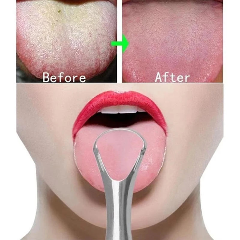 VitaCare™ PureBreath Single-Layer Stainless Steel Tongue Cleaner