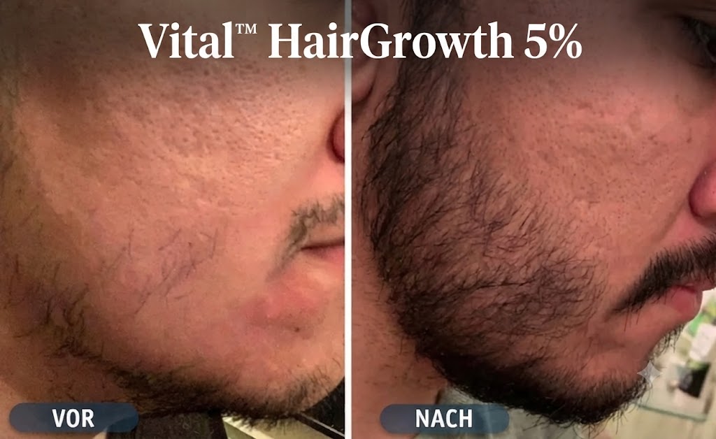 Vital™ HairGrowth 5% – Ansicht 4