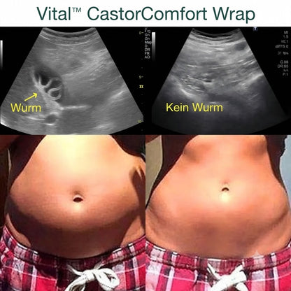 Vital™ CastorComfort Wrap – Ansicht 7