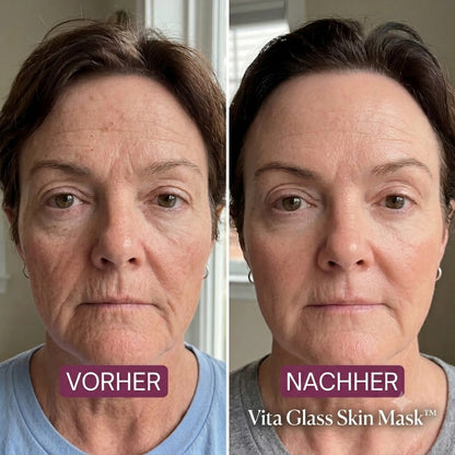 Vita Glass Skin Mask™