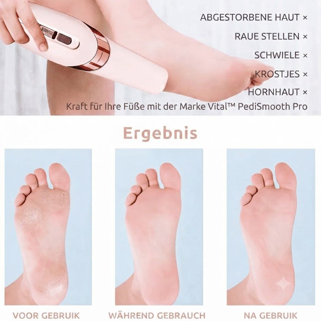 Vital™ PediSmooth Pro – Ansicht 4